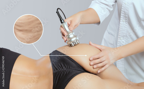 The doctor does the Rf lifting procedure on the legs, buttocks and hips of a woman in a beauty parlor. Treatment of overweight and flabby skin.Cosmetology and professional skin care.