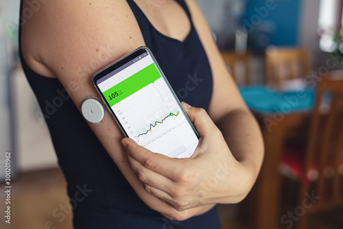 Woman checking glucose level with a modern technology remote sensor and mobile phone, without blood. Diabetes treatment.