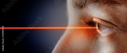 eye laser surgery concept