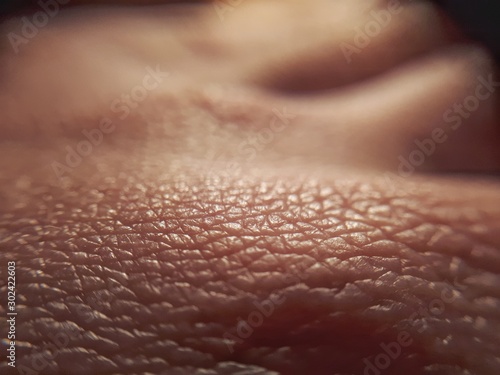 macro skin of human hand.Medicine and dermatology concept. Details of human skin background.