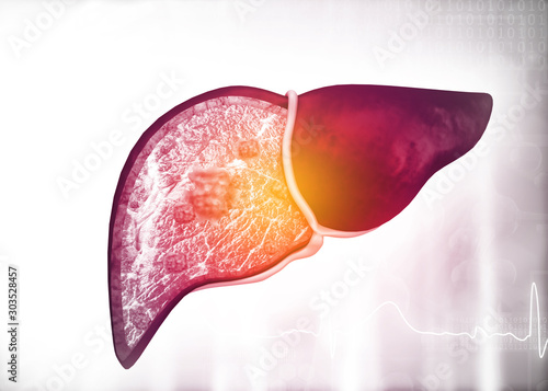 Diseased human liver on science background. 3d illustration .