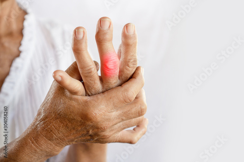 Asian woman hand suffering from joint pain with gout in finger