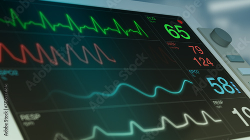 closeup view of an ecg ekg monitor on a operating room