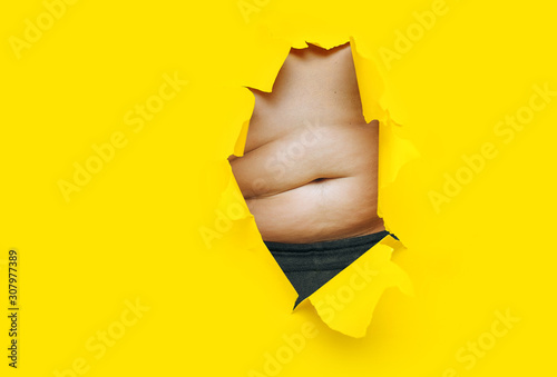 Male fat, flabby stomach in a torn aperture of yellow paper. The concept of beer belly, gluttony and cellulite. Copy space.