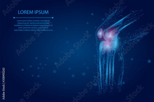 Abstract mash line and poin Human knee joint. Low poly design cure pain treatment vector illustration