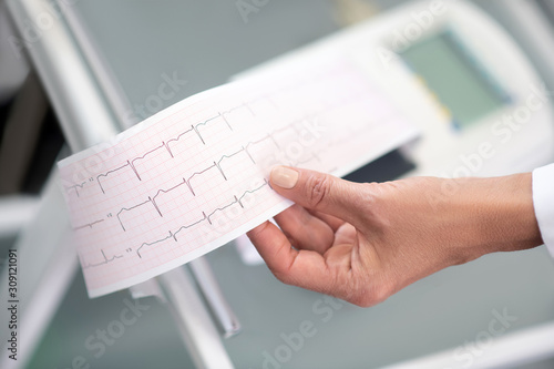 Close up of doctors hand with electrocardigram result