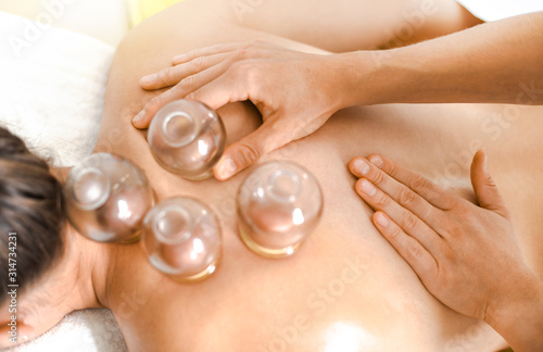 Detail of a woman therapist hands giving cupping treatment on back.