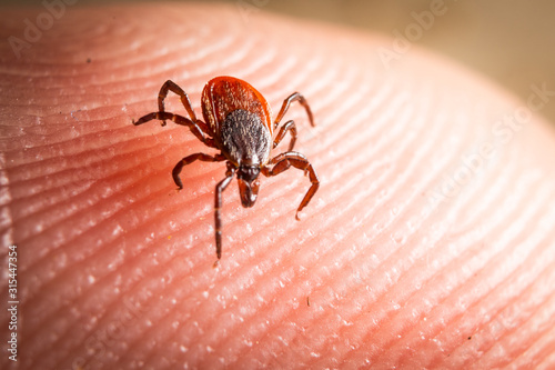 Deer Tick on Skin