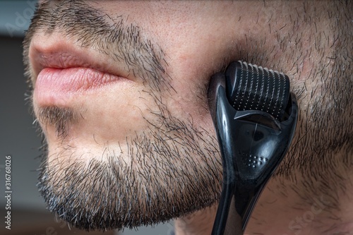 Facial hair care concept. Young man is using derma roller on beard.