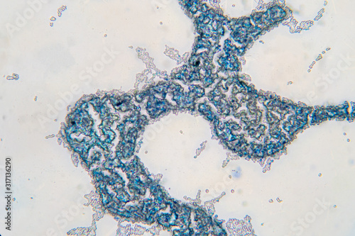Saccharomyces cerevisiae yeast budding cell under microscope.