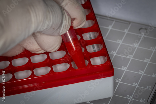 Doctor with blood sample and field test kit equipment for coronavirus