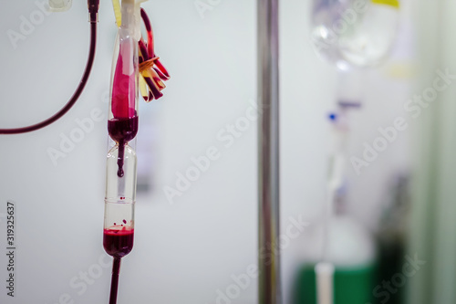 Closeup Blood transfusion to a patient in the hospital hand held shooting