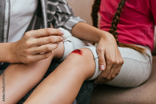 cropped view of mother holding antiseptic cotton near wound on knee of daughter