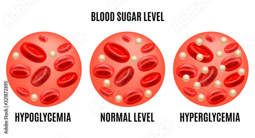 Realistic Detailed 3d Glucose Blood Level Ad Poster Card. Vector