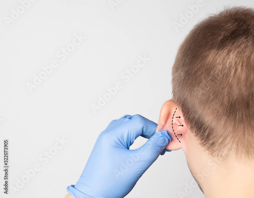 A plastic surgeon doctor examines a male patient s ear for an otoplasty operation. The concept of removing deafness, copy space