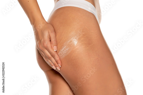 woman applying stretch marks lotion on her bottom