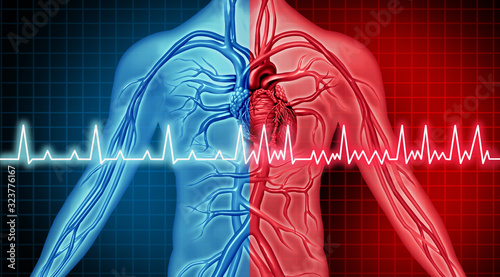 Atrial Fibrillation Disorder