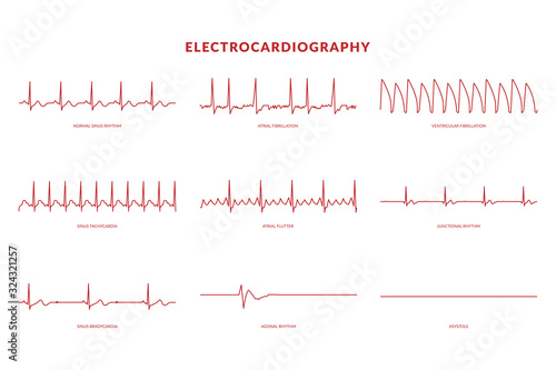 Electrocardiography Heartbeat Line monitor. vector EPS10 Illustration