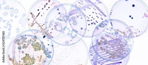 Growing Bacteria in Petri Dishes on agar gel Scientific experiment.