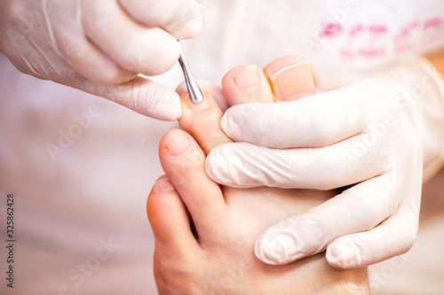 Cuticle treatment for pretty and clean toenails, men’s pedicure toenail concept