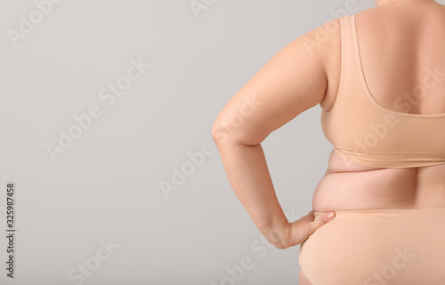 Overweight woman with cellulite problem on light background