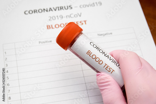 Coronavirus, covid19 - blood test. Test krwi - koronawirus.