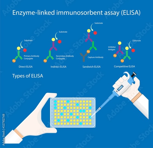 Enzyme linked immunosorbent assay ELISA Immunoassay EIA antibodies infectious technician analyze
