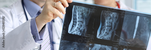 Close-up of doctors hands holding x-ray vertebra in different projections. Physician colleagues discussing diagnosis of patient. Medicine and healthcare concept