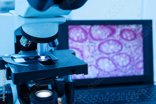 Modern microscope and human tissue section slide with computer monitor show glandular image.Medical patholology and cytologytechnology concept.Selective focus.