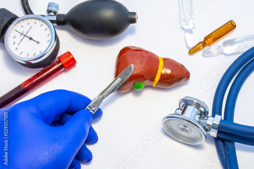 Concept photo of liver surgery, operation of liver resection or hepatectomy. Doctor with scalpel in hand makes incision in figure of human liver, which is located near medical toolkit - stethoscope