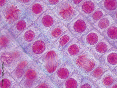 Cells of an onion root tip undergo mitosis. Anaphases and metaphases under microscope.