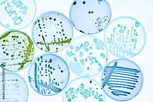 Mixed of bacteria colonies and fungus in various petri dish