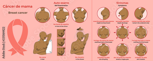 Self examination and Symptoms of breast cancer. Medicine, pathology, anatomy, physiology, health. Infographic. Healthcare poster or banner template. Text in portuguese and in English. Vector illustr