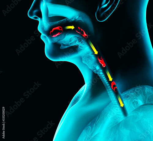 Disorders of swallowing, dysphagia. Pharyngeal and esophageal dysphagia. Oral phase. The path of food, the act of swallowing. Person ia x-ray, 3d render. 