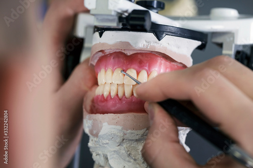 dental technician creates removable dental prostheses with pink gum