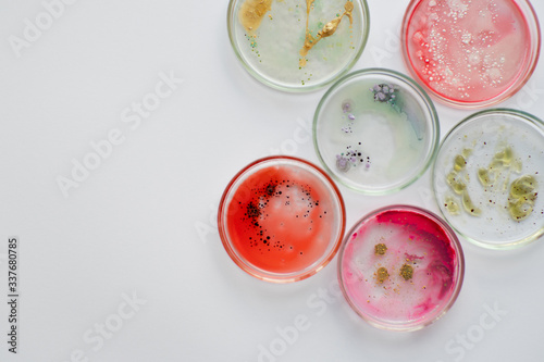 Viruses and bacteria in a Petri dish, studying the growth of bacteria on different samples in the laboratory.