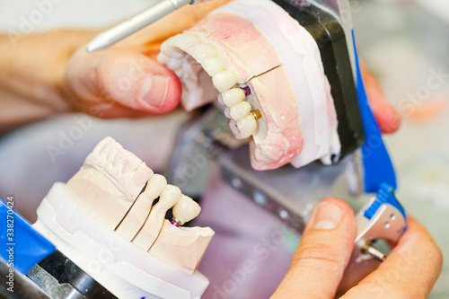 dental technician working on a tooth crown