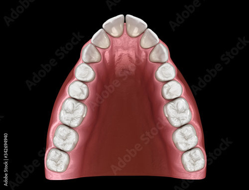 V-shape tapered arch form of maxilla. Medically accurate tooth 3D illustration