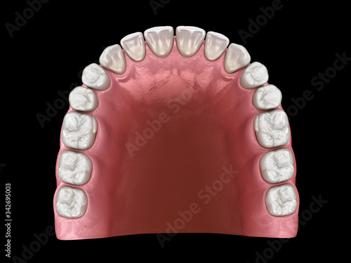 U-shape ovoid arch form of maxilla. Medically accurate tooth 3D illustration