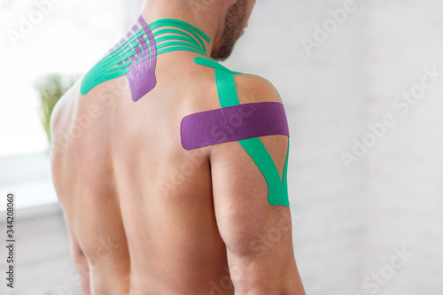 Kinesiology taping. Kinesiology tape on patient neck. Injured trapezius muscles treatment of young male athlete. Post traumatic rehabilitation, sport physical therapy, recovery concept.