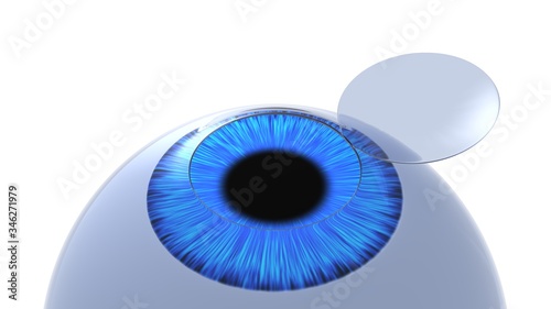 Corneal flap eye illustration. Isolated on white. 3D-rendering.
