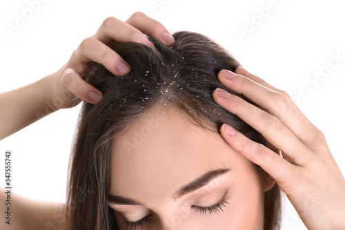 Woman with dandruff in her hair on white background, closeup