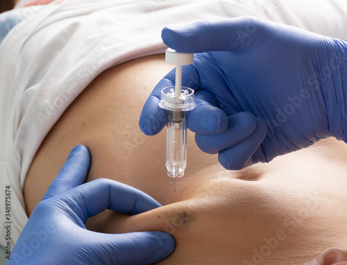 COVID-19 pneumonia patient is given a subcutaneous injection of an anticoagulant to prevent thrombosis Hands in blue medical gloves are holding a syringe with medicine Bruises from previous injections