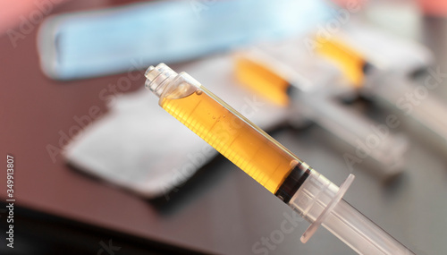 Blood plasma in a syringe on a blurred background. Blood plasma as a solution for the treatment of coronavirus. Platelet-rich plasma preparation for plasmolifting therapy. Selective focus.