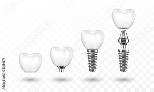 Tooth implant in disassembled form