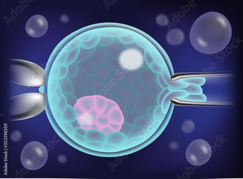 Human blastocyst, embryo biopsy after IVF or ICSI for preimplantation genetic screening, 3D illustration