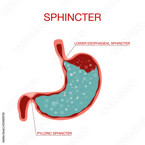 Pyloric sphincter of the stomach duodenum. Pylorus. Lower esophageal sphincter doesn’t relax.