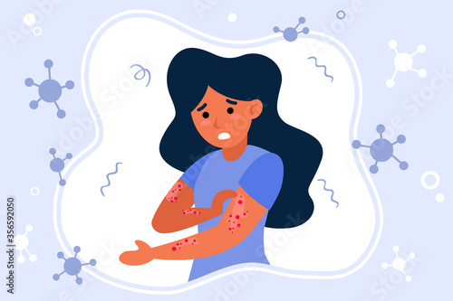 Person suffering from rush. Hives, fever, stress, chickenpox flat vector illustration. Illness, epidemics, virus concept for banner, website design or landing web page