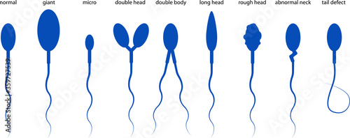 Sperm morphology. Normal and abnormal sperm.