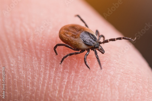 Female deer tick on skin of human finger. Ixodes ricinus or scapularis. Close-up of dangerous parasitic mite in dynamic motion on fingertip with friction ridges. Diseases transmission as encephalitis.